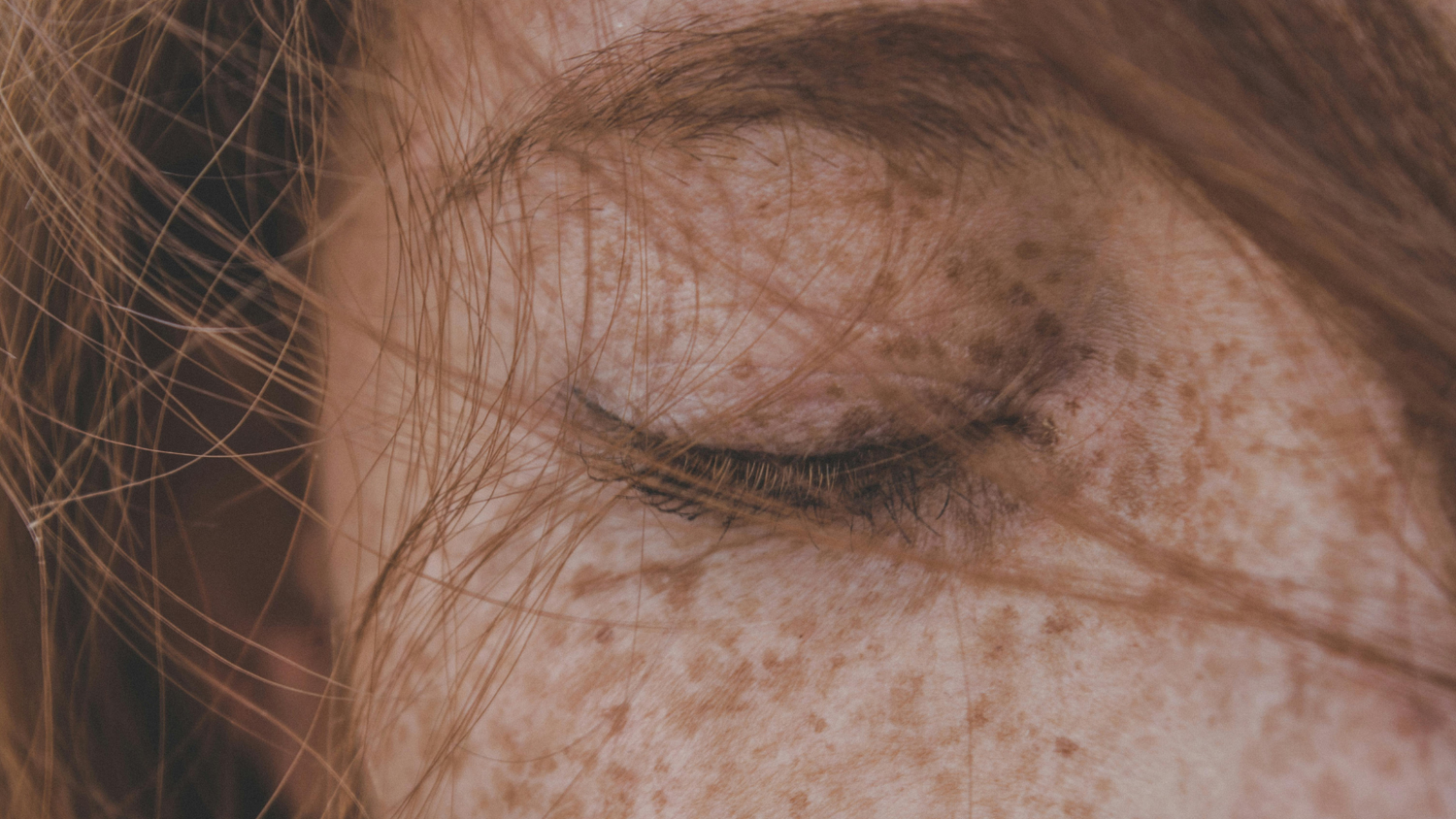 Schönheit kommt von innen – und was dein Darmmikrobiom mit ihr zu tun hat